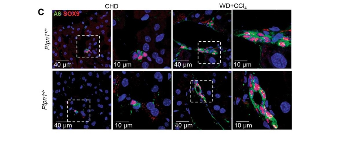 Estudian en células ovales cómo la inhibición del gen Pptn1 protege contra la lipotoxicidad favoreciendo la formación de gotas lipídicas