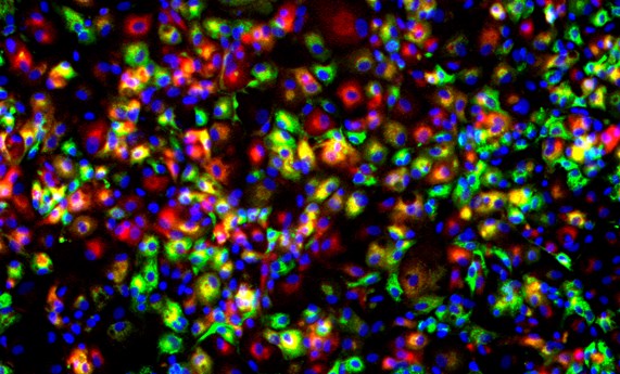 Estrategia pionera y mínimamente invasiva para la generación de hepatocitos de pacientes individuales para estudios farmacotoxicológicos hepáticos Estrategia pionera y mínimamente invasiva para la generación de hepatocitos de pacientes individuales para estudios farmacotoxicológicos hepáticos