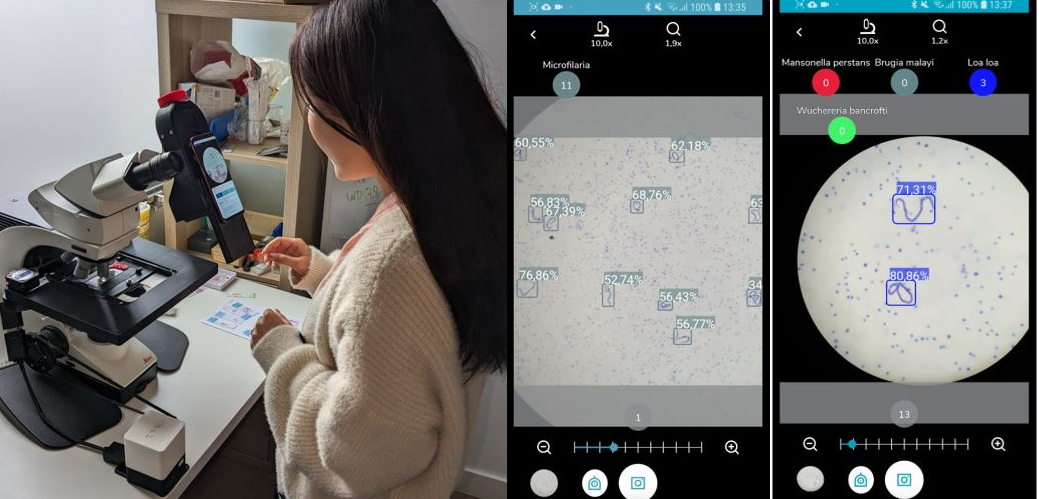 Inteligencia artificial en un teléfono móvil para diagnosticar enfermedades tropicales desatendidas