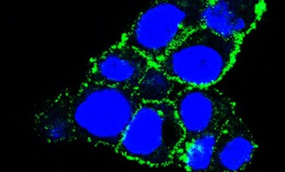Desarrollan una nueva terapia dirigida al cáncer de pancreas Desarrollan una nueva terapia dirigida al cáncer de pancreas