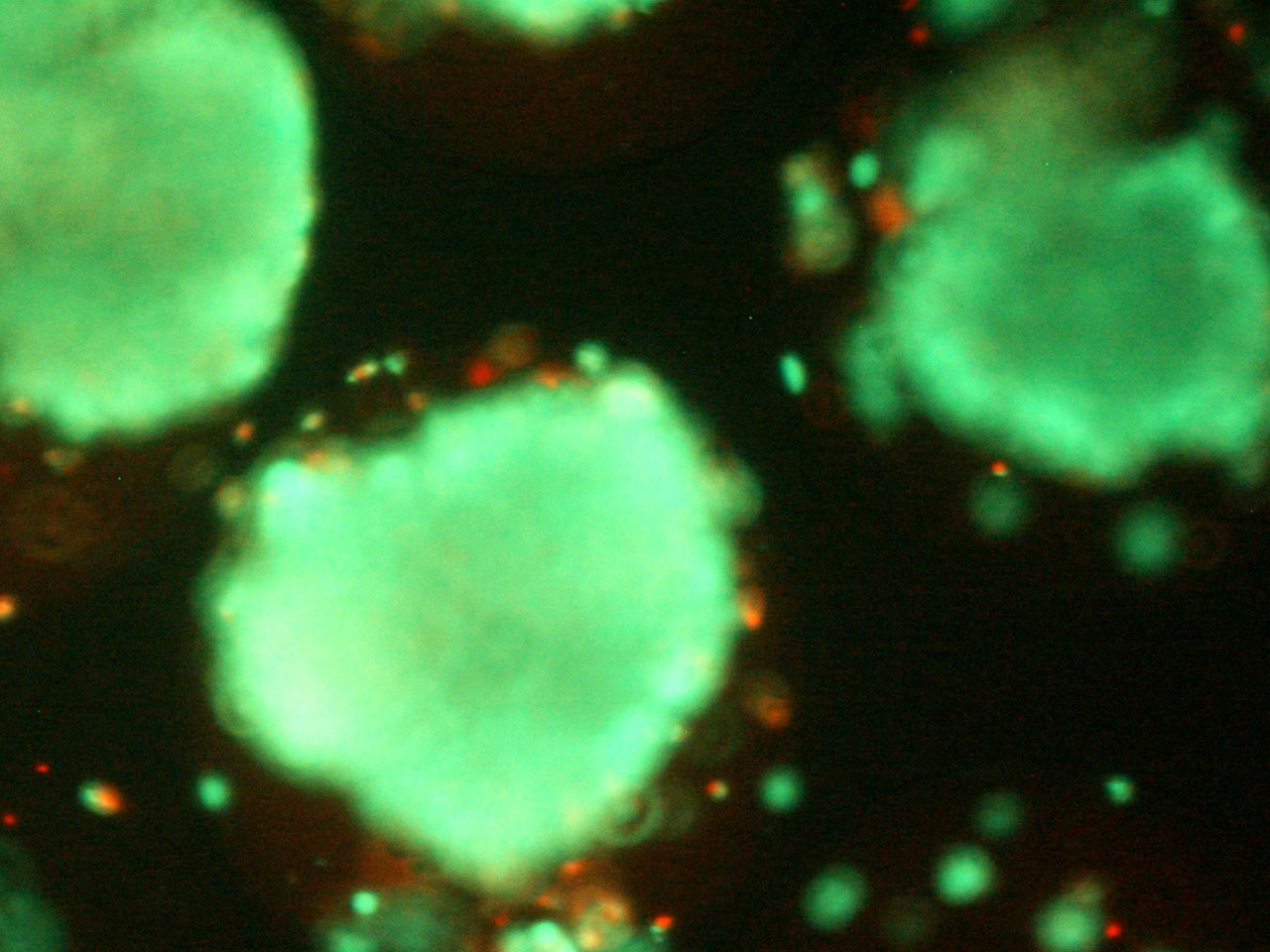 El CIBER-BBN participa en un consorcio europeo para desarrollar materiales y tratamientos celulares para la diabetes