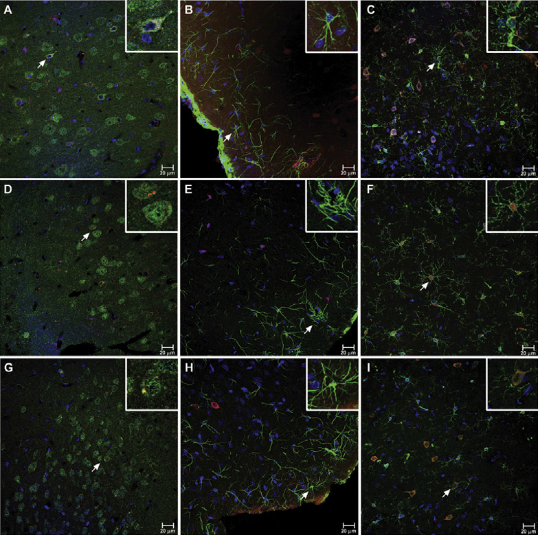 Posible papel de la translocación bacteriana intestinal en la fisiopatología de la depresión
