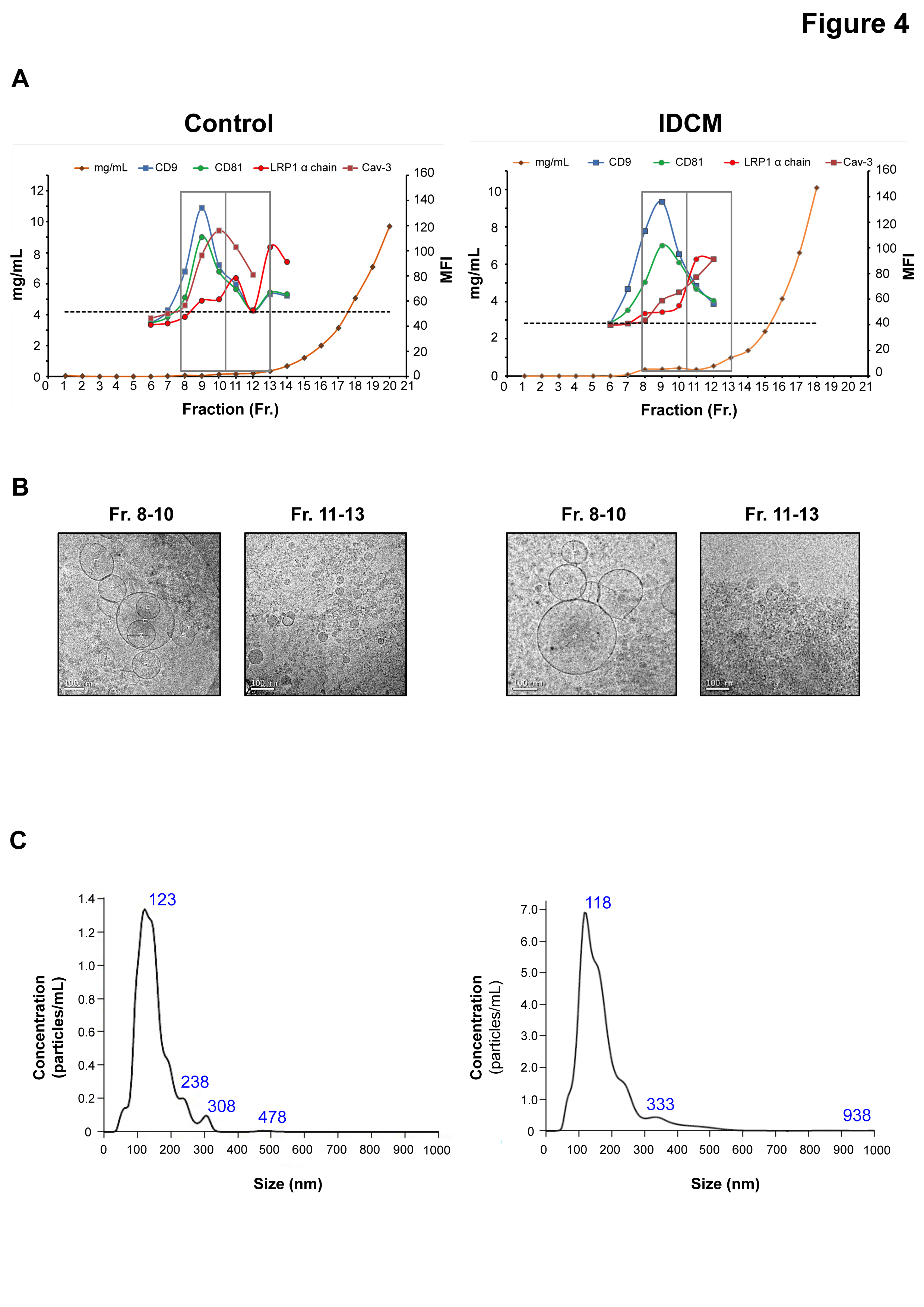 Hallan un nuevo biomarcador para los pacientes con miocardiopatía dilatada idiopática
